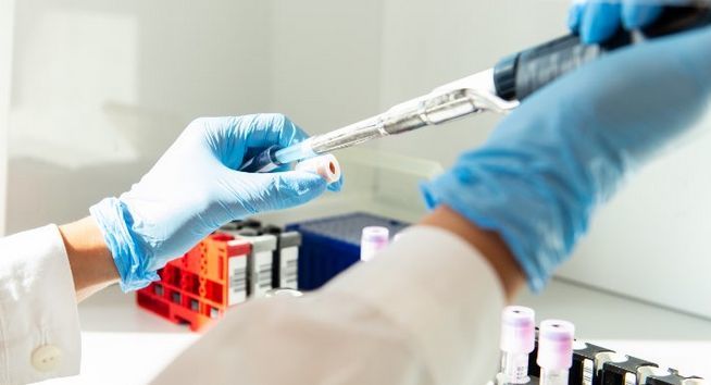 VIRUS – Test sierologici a partire dal 4 maggio in Piemonte