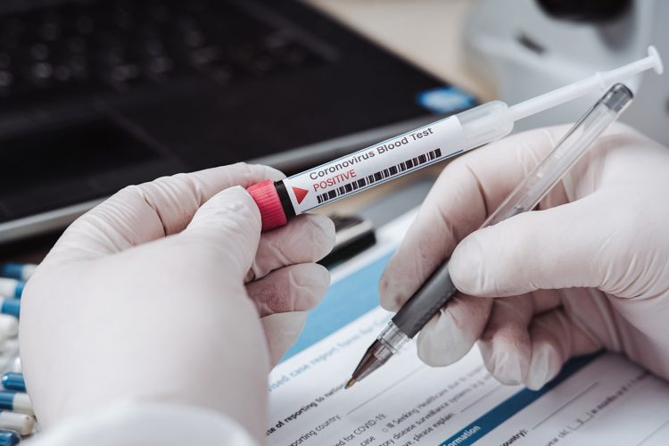 VIRUS – La Regione: “Il Governo faccia chiarezza sulla gestione dei test sierologici”