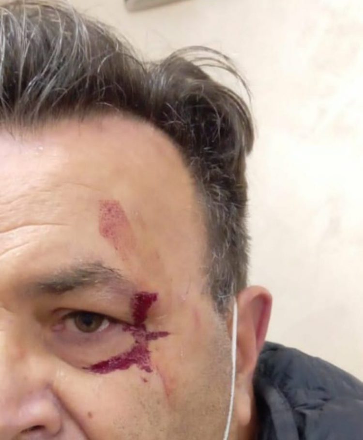 MONCALIERI – Preso a pugni per un colpo di clacson